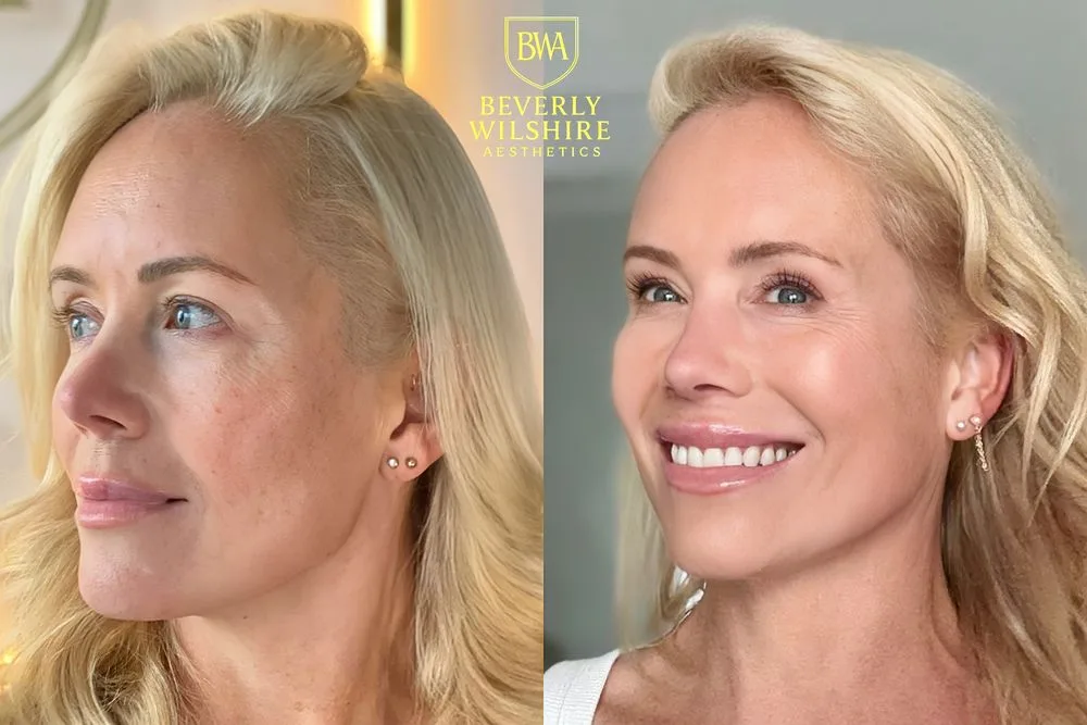 Beverly Wilshire Aesthetics